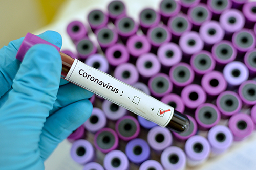 CoronaVirus